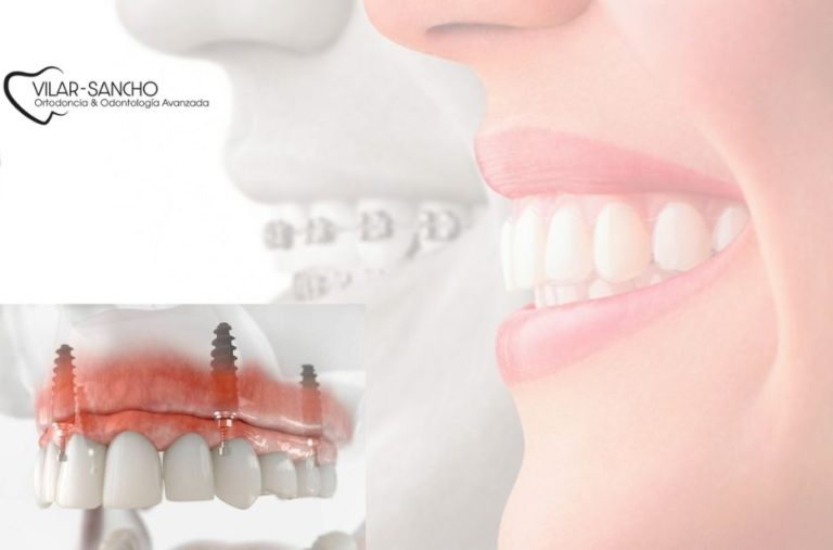 Cuida tu sonrisa: hábitos clave para una salud bucal duradera Cuida tu sonrisa: hábitos clave para una salud bucal duradera