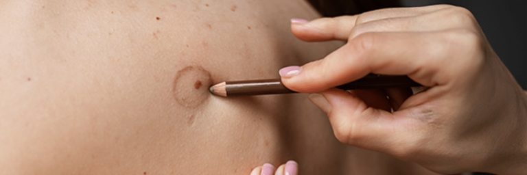 Revitalise Your Look: Dubai’s Scar Camouflage Solutions