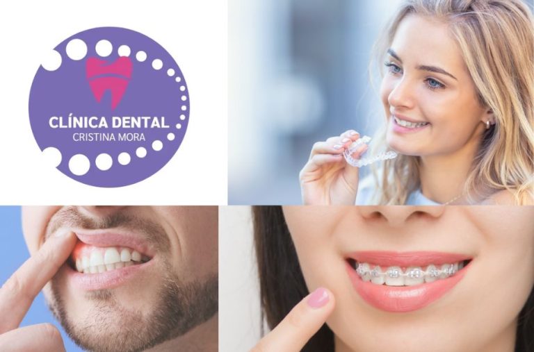 Implants dentals a Gines: guia pràctica i options