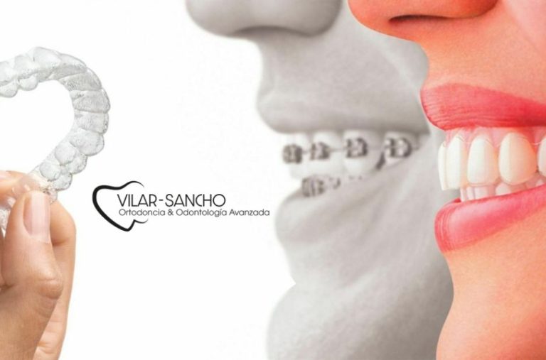 Tratamientos estéticos y dentales en Pozuelo de Alarcón Tratamientos estéticos y dentales en Pozuelo de Alarcón