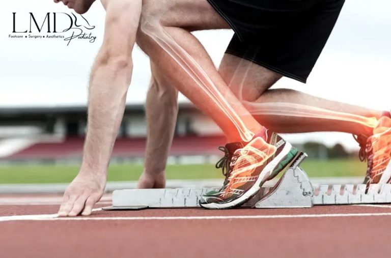 Relief Tactics for Foot Callus Pain