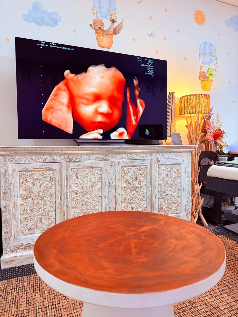 Reveal the little one: expert 4D scans for families in WA