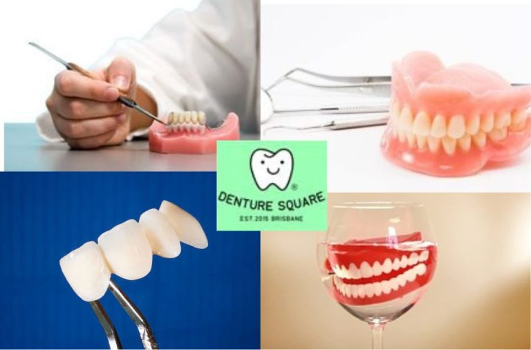 What to expect for denture repair pricing and options What to expect for denture repair pricing and options