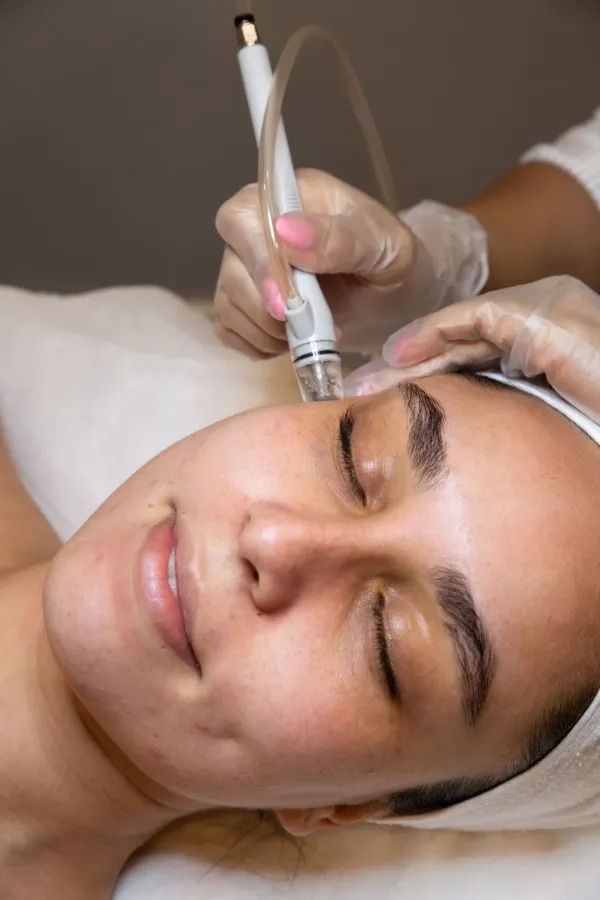 Revitalize Your Glow with a Hydra Facial in Oakville Revitalize Your Glow with a Hydra Facial in Oakville