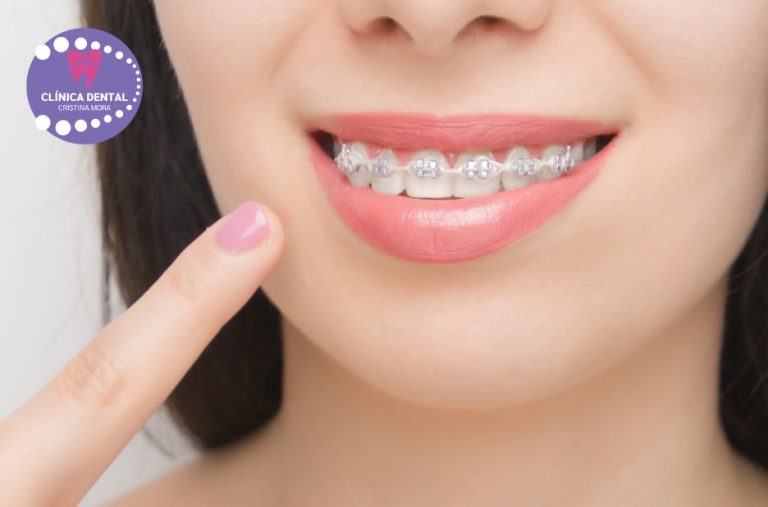 Implants dentals Gines: guia pràctica i options