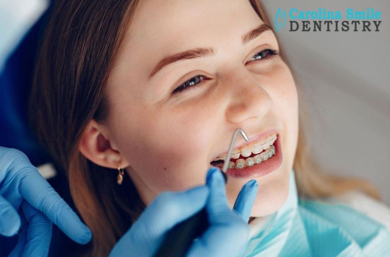 Enhancing Smiles with Bonding and Fluoride Care in Charlotte Enhancing Smiles with Bonding and Fluoride Care in Charlotte