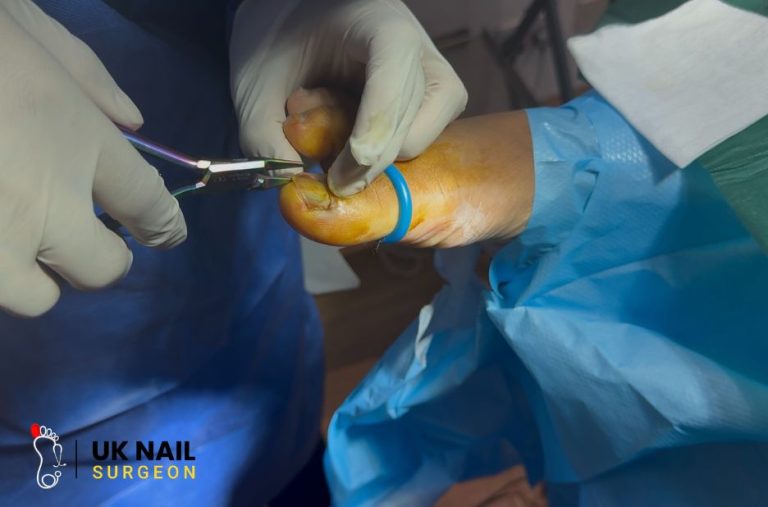 Expert Toe Nail Care Nearby: Safe Treatments and Relief Expert Toe Nail Care Nearby: Safe Treatments and Relief