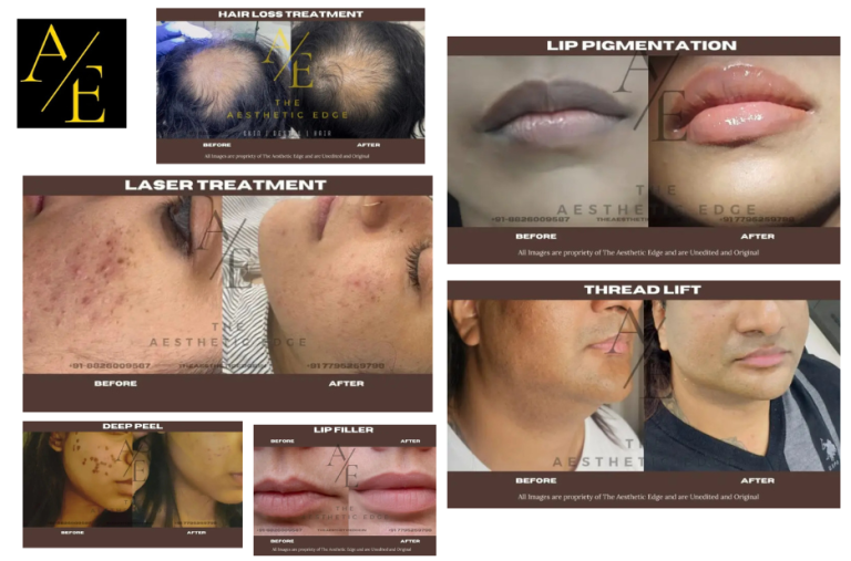 Top Skin and Hair Clinic in Bangalore for Expert Care and Advanced Treatments