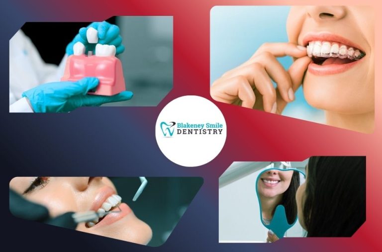 Trusted Ballantyne Charlotte Dentist for Your Family’s Smile Trusted Ballantyne Charlotte Dentist for Your Family’s Smile