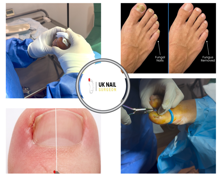 Expert Nail Care: Finding a Qualified Clinic Nearby