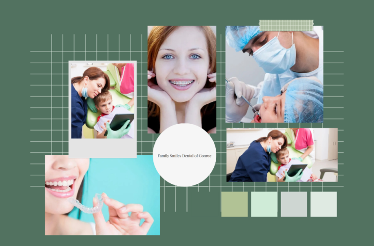 Affordable Dental Bonding Conroe | Transform Your Smile Today