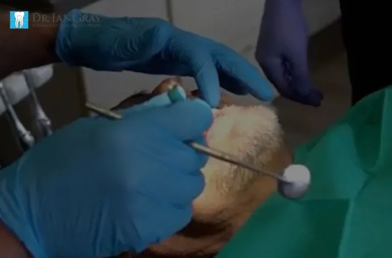 Professional Teeth Whitening Newmarket Services for a Brighter Smile