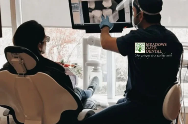 Effective Dental Cavity Prevention in Pitt Meadows for a Healthy Smile
