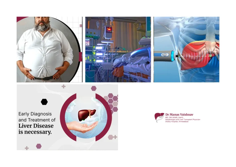 Top Best Liver Doctor in Ahmedabad for Expert Hepatology and Liver Disease Care