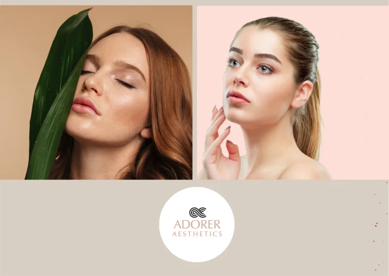 Expert Skin Specialist for Pimple Nilakh Treatment at Adoreraesthetics.com
