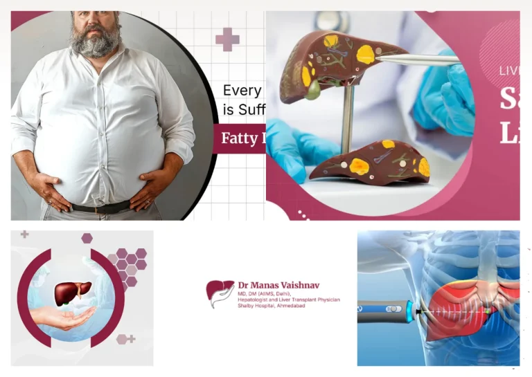 Expert Liver Transplant Surgery in Gujarat | Comprehensive Care and Support