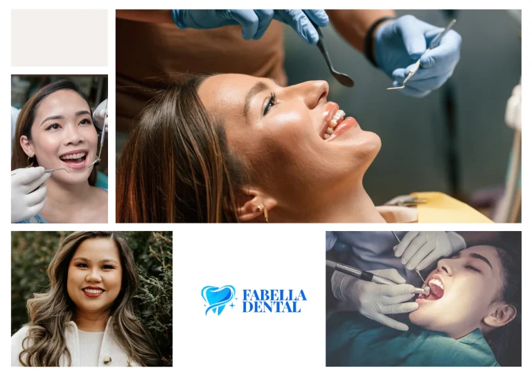 Reliable Dental Filling Ottawa Services for Durable and Precise Cavity Repair