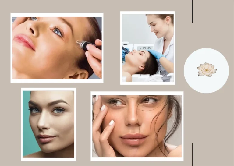 Experience Trusted Skin Renewal with Morpheus 8 Treatment at Lotus @ Queensway Medical Experience Trusted Skin Renewal with Morpheus 8 Treatment at Lotus @ Queensway Medical