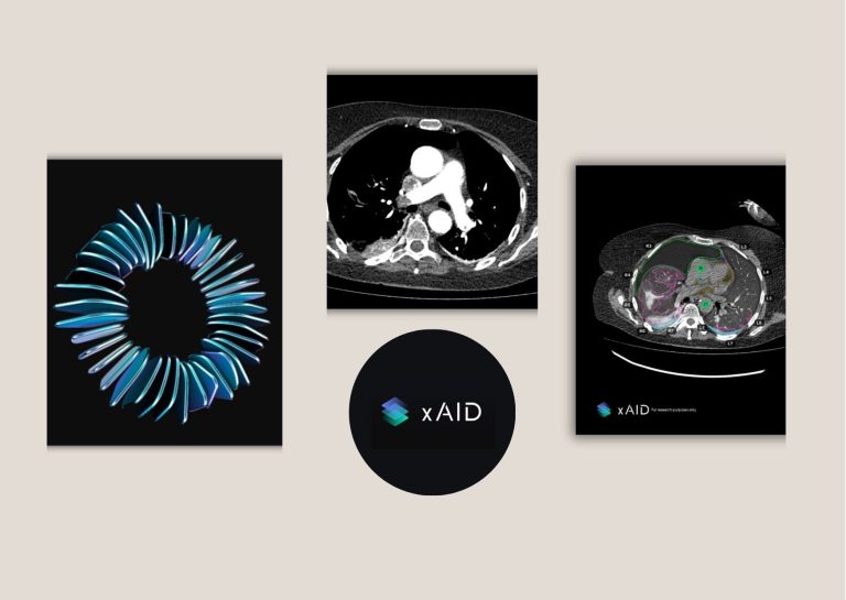 Local AI Medical Imaging Support for Radiology Teams